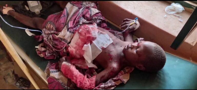 مجزرة الهدار بجبال النوبة